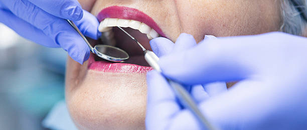 Best Emergency Dental Services for Seniors in Monroeville, OH
